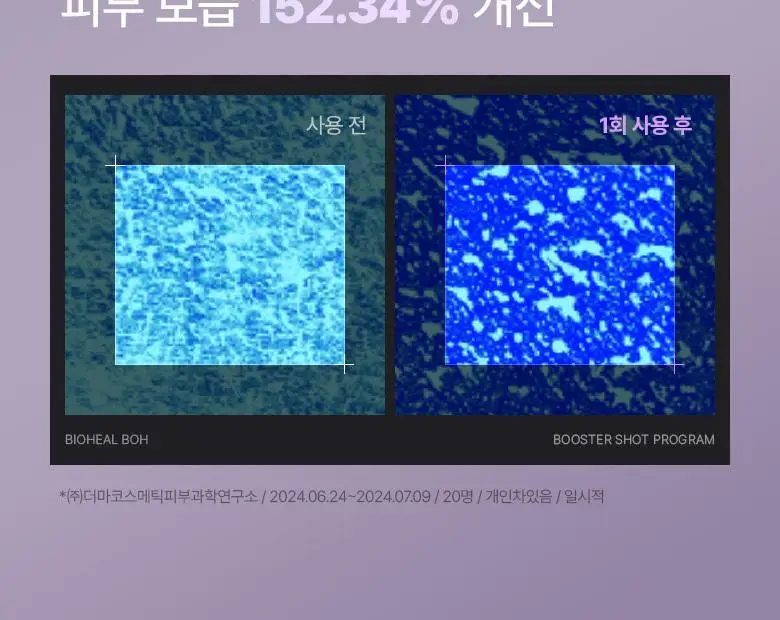 [PDRN] 바이오힐 보 프로바이오덤 콜라겐 리모델링 부스터샷 프로그램 35ml [단품/증정기획] 상세페이지 32